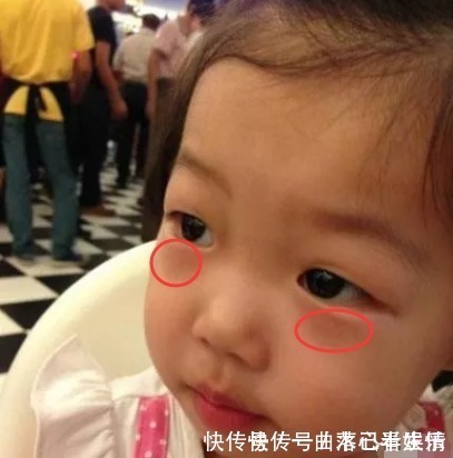 莱菔子|一旦发现孩子出现7个表现,说明脾胃已经“弱爆了”,及时健脾