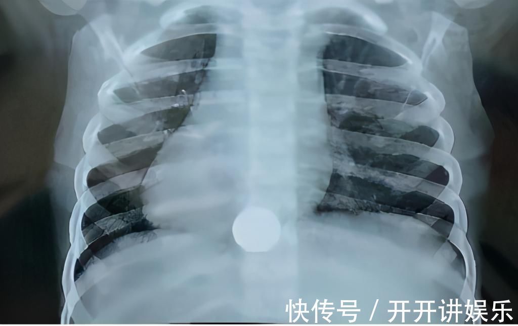 美容|孩子误吞硬币、意外受伤该怎么办?儿科医生提醒:这样做才正确