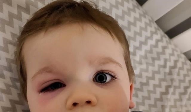 男孩|洗澡鸭险致男孩双目失明,这类网红玩具一定要经常更换,父母注意