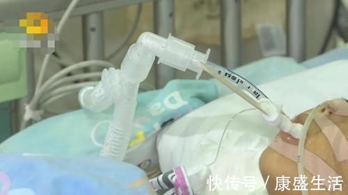 采摘|一家四口吃完饭,2岁弟弟和3岁哥哥相继身亡,医生说出原因太揪心