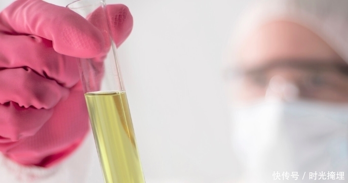 尿蛋白1十怎么调理?医生:现在明白也不迟