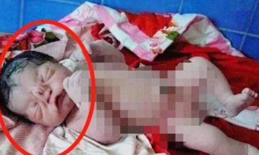 反而|50岁产妇生下“猪八戒”，遭全家人嫌弃，医生的反而一句话救了娃