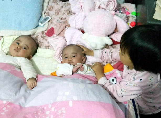 姚甜甜|早产双胞胎姐妹遭遇罕见病,出生时不足两斤,腿还没爸爸手指粗