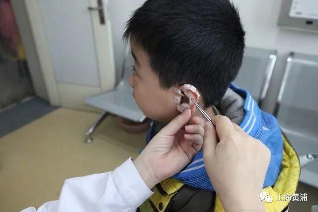 單純性近視|青少年近視？這份中醫指南收好