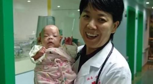 死神|出生轰动全国,14年前体重不足500克的“早产儿”,现在咋样了