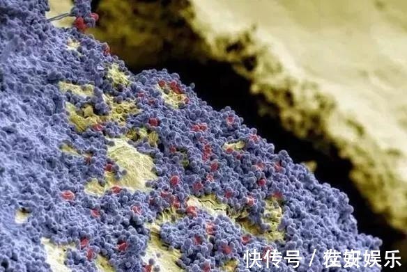 龋齿|4岁男孩牙齿几乎全黑6岁前,不要让孩子自己刷牙!