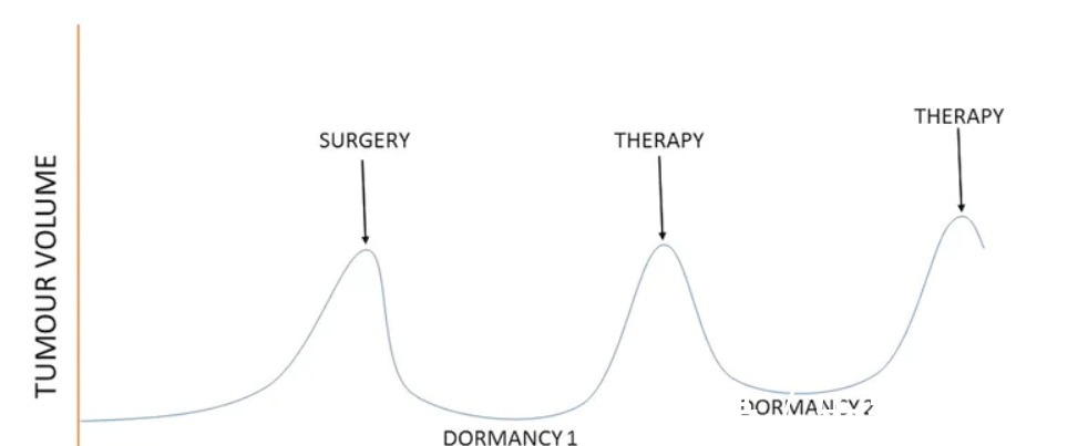 休眠|如何延缓癌症复发教你3个方法,不花一分钱,让癌细胞休眠!
