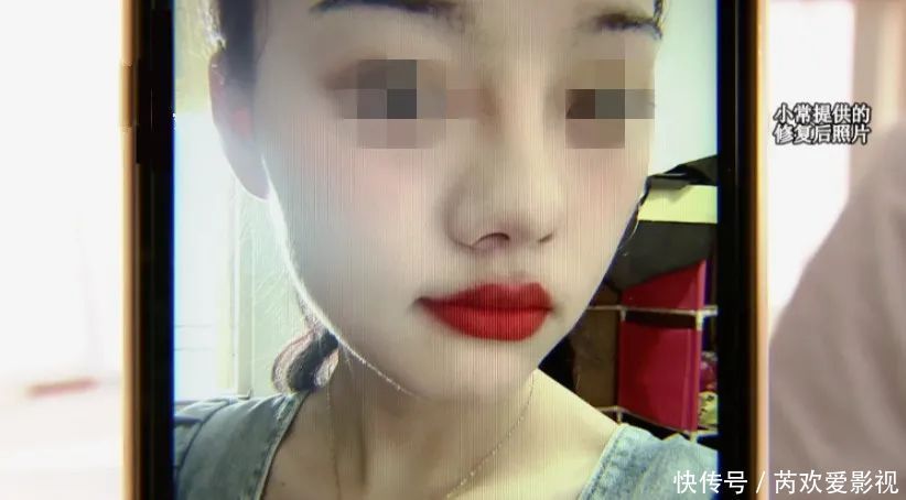 漂亮姑娘刚怀孕,鼻尖出现神秘白色物体!婆婆追问下,她瞒不住了…