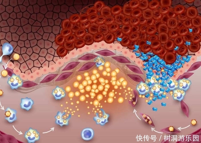 血管|高血脂不用愁,多吃这几样食物,帮你清血管降血脂,身体更健康