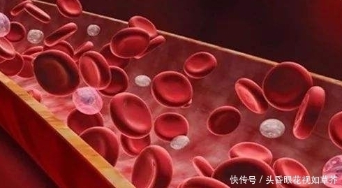 血栓天敌被发现了,每天吃2口,清血管冲走血栓,杜绝高血脂