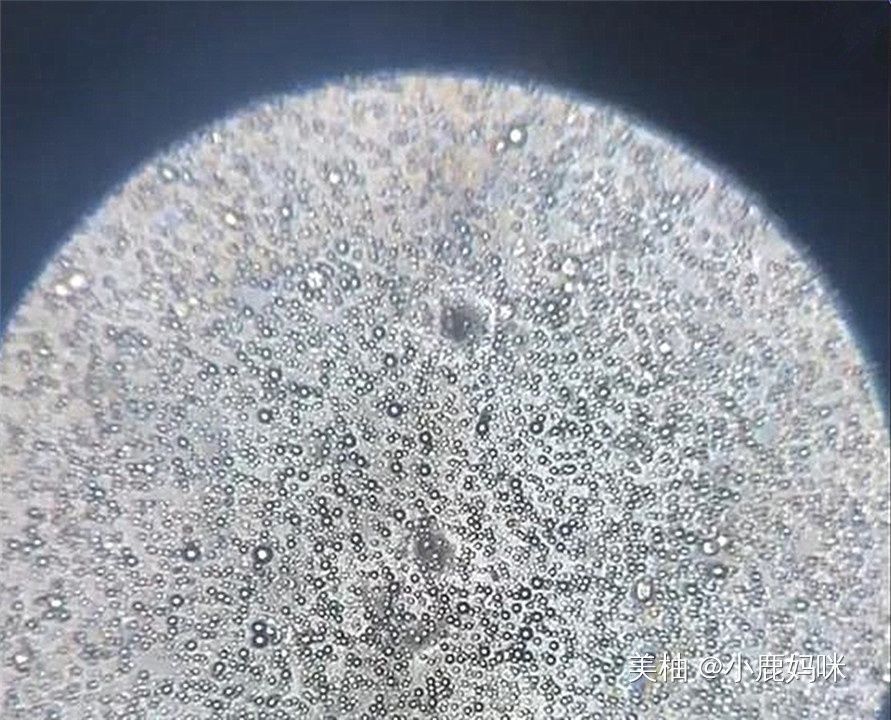 将母乳放大1000倍是什么样显微镜下的图片,当妈的都该看看