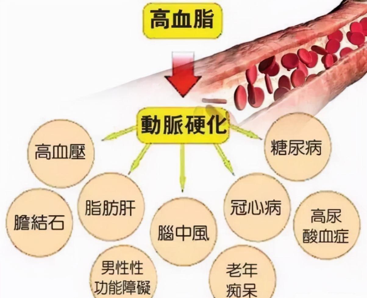 血脂异常|瘦子也会得高血脂？降低血脂遵守“四低一高”原则很重要