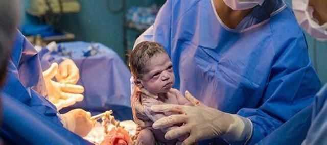 弄出来|“就是你把我弄出来的”宝宝出生时脸太臭,医生都被盯毛了