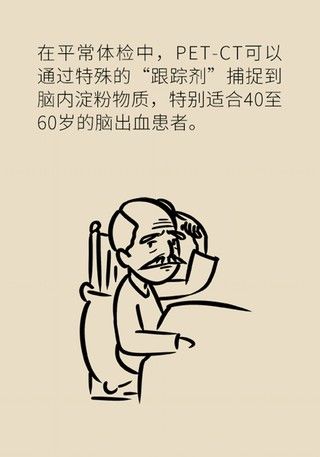 瞌睡|记性变差容易瞌睡，有可能是这种脑出血