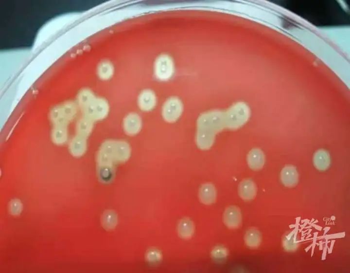 致病菌|警惕！37岁男子吹空调住进ICU！住了一周未脱险