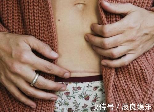 剖腹产|“宁愿肚皮挨刀也不顺产”,二胎宝妈说出心里话,好处再多也不选