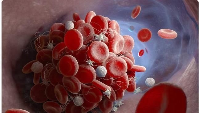 视力|血管的“去污剂”不是芹菜,平时紧着吃,给血管冲冲澡,血脂降了