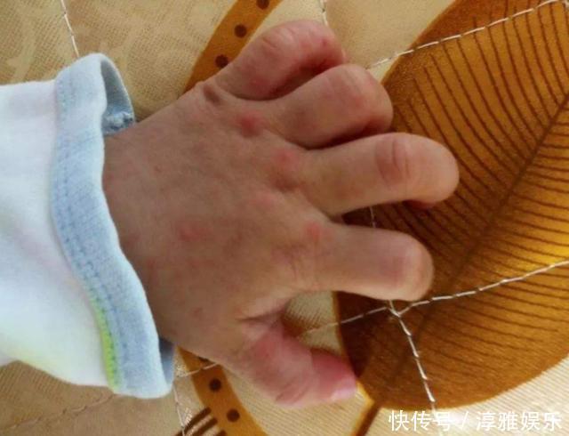 又到了宝宝的“手足口”高发期,别再让你的宝宝“受罪”了!