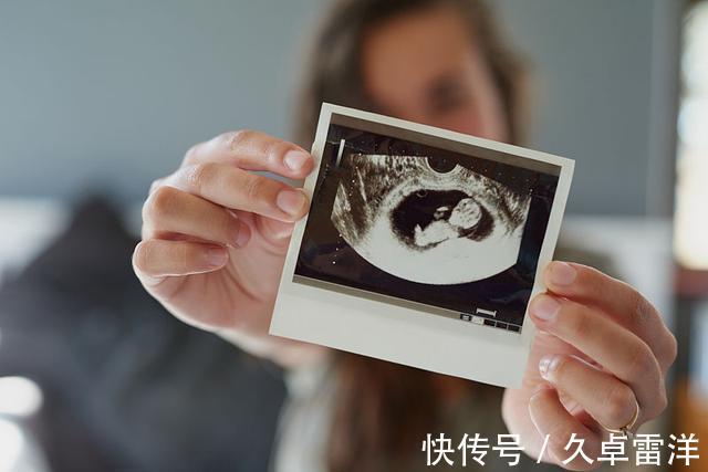 孩子|每次产检结果正常,孩子生出后发现畸形,医院需要负责吗