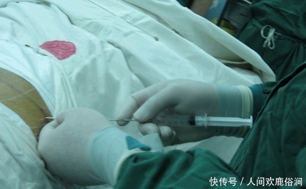 一个月|剖腹产的女性多长时间才可以“洗澡”产科大夫给了建议,别忽视