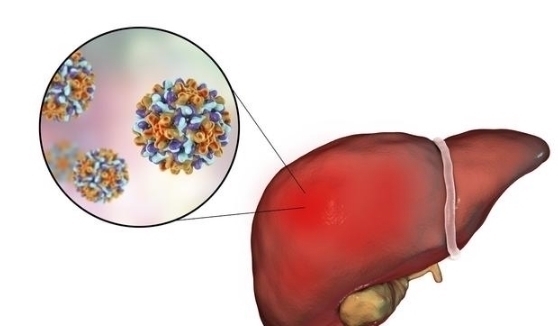 天敌|开水里放几片，肝炎的“天敌”，每天喝一点，逼出多年肝毒