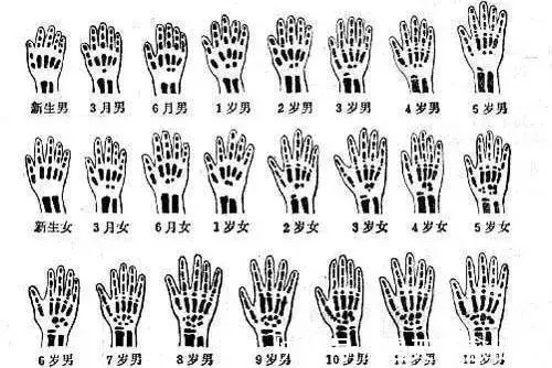 偏大|骨龄能看出孩子生长发育情况吗,了解影响身高增长的关键因素!