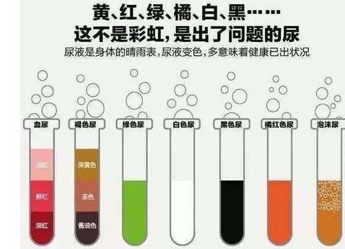  其颜色看起|尿液出现这些情况，可能是身体出现了疾病问题，别不当回事！