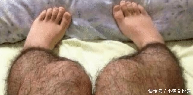 为什么有人腿毛旺盛,有人却“光溜溜”?女护士无奈说出实情