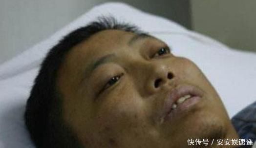 肝脏|肝硬化才不会“悄无声息”,早期信号一定别忽视,还好早知道