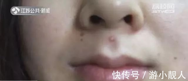 毛孔 小心!以下5个护肤坏习惯,能让你的毛孔越来越大……