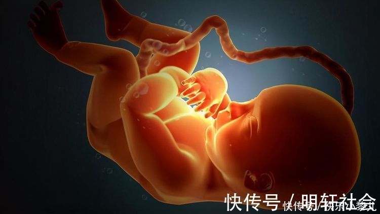 陈香|怀孕期间,这几周胎儿最容易脐带绕颈,孕妈要做好预防工作