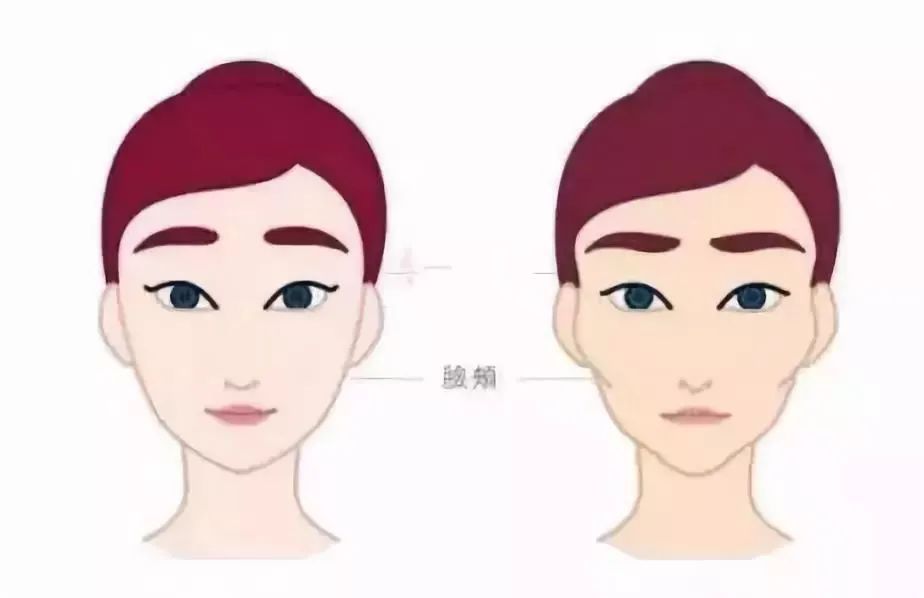 自体脂肪丰面颊|面部填充玻尿酸vs自体脂肪如何选?丨科普篇