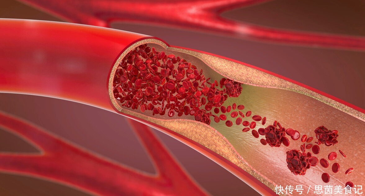 内壁|94岁老中医,血管内壁光滑如40岁,就因每周吃3次一种菜