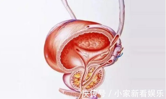 男性|吃一次相当于8斤韭菜,泌尿科主任:你若爱吃,前列腺会感激你