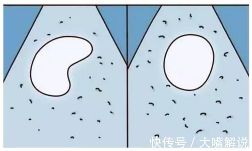 性别|那些民间流传的胎儿性别鉴别土方法,就服第3种办法