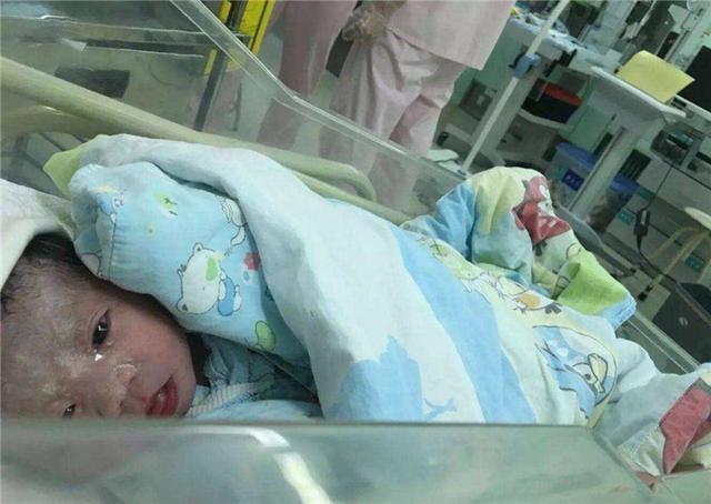 嫌弃|“黑脸宝宝”被全家人嫌弃,两个月后完美逆袭,宝妈:幸好没丢掉