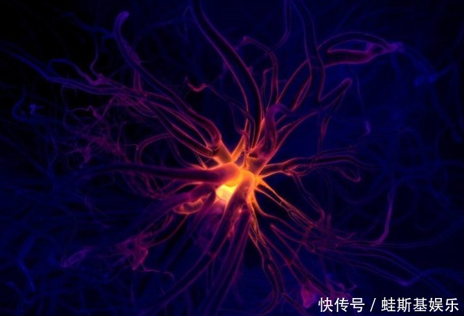 最新痴呆测试出来了!5张图看出大脑健康程度,回答越慢越危险!