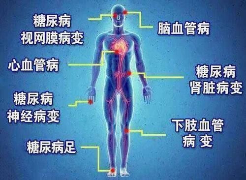 微循环|糖尿病有救了!疏通微循环恢复自愈力,有望逆转并发症