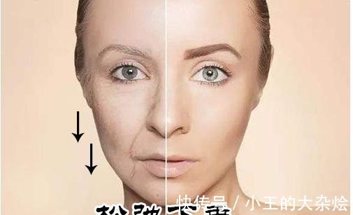 面部 做过3次线雕的她,为什么还要跑来做拉皮手术!