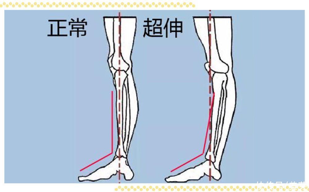 服了！到底什么样的腿才能算美腿啊
