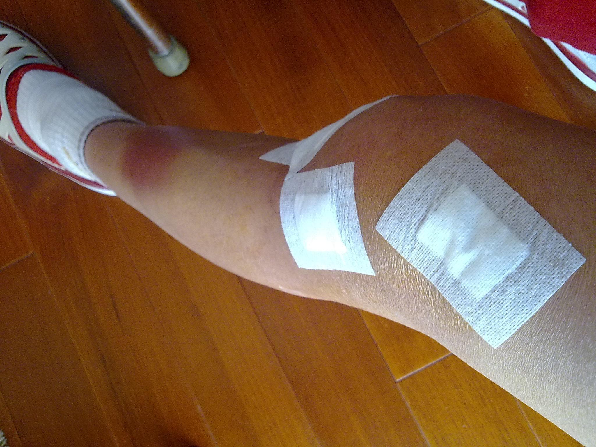 骑自行车|关节炎患者注意了!若是关节一动就响,做好这3点可有效改善