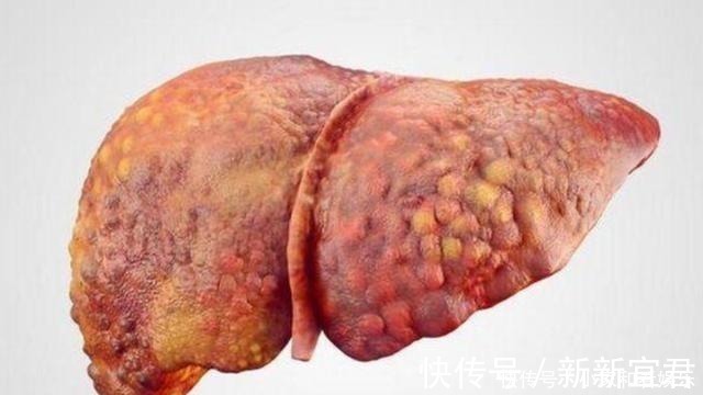 保护心脏|每天喝一两白酒，一年后身体会有什么变化？快来听听医生的回答