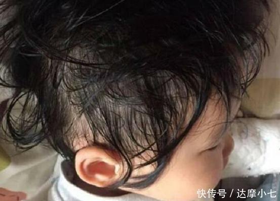 男童|吃1次等于吃10个塑料袋,7岁男童积食不长个,只因“毒晚餐”