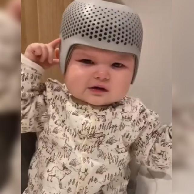 父母|宝宝头睡扁了,没想到戴上头盔却是这样的反应,网友看着都心疼