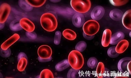 痛风|高尿酸导致痛风苦不堪言，医生：做到这2点，让你尿酸嗖嗖降