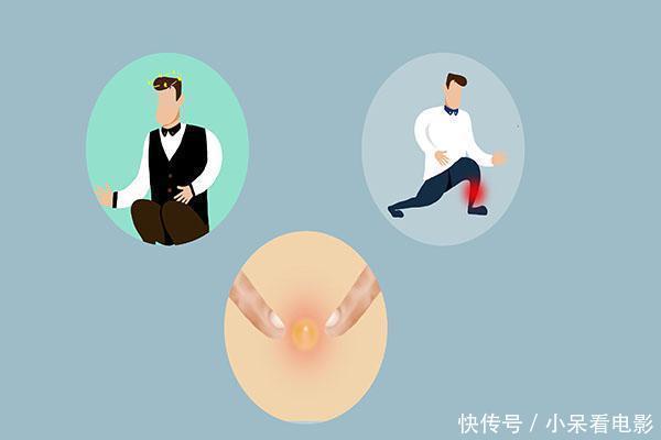 异常|血脂高不高,看看脸就知,脸上出现哪些异常,提醒你要降血脂?