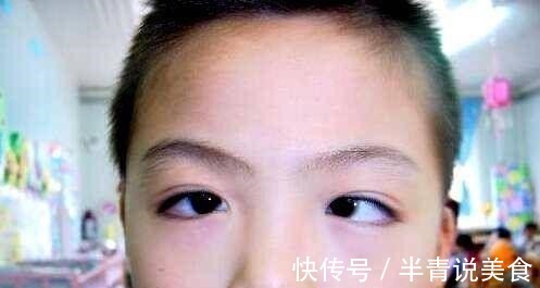 黑眼珠|5岁男孩一觉醒来,黑眼珠“消失”了,医生家长别太惯着孩子