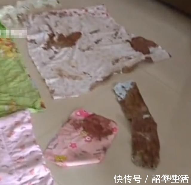 脐带|女子剖腹产后孩子尿不湿里全是血,竟是脐带没扎好,医生这是你自己原因