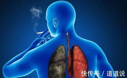 阻塞性|肺气肿病发的原因是什么?