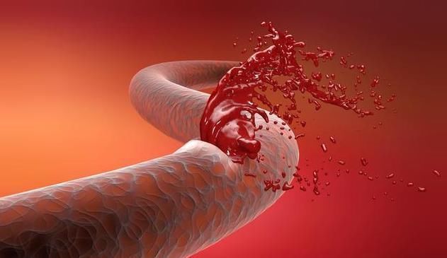 身体有5个表现,脑血管可能堵塞了,50岁以后,